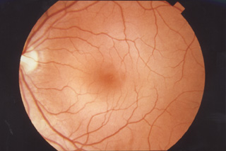 An image of a human retina