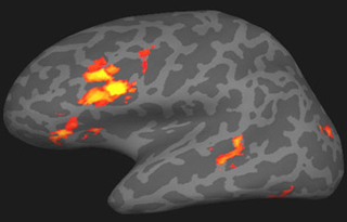 Representation of a brain during memory aquisition task, showing the associated areas that are employed during the task in different colors.
