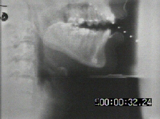 X-ray of person speaking.