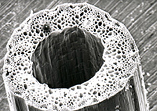 A microscope photograph of a plant stem's cross-section.