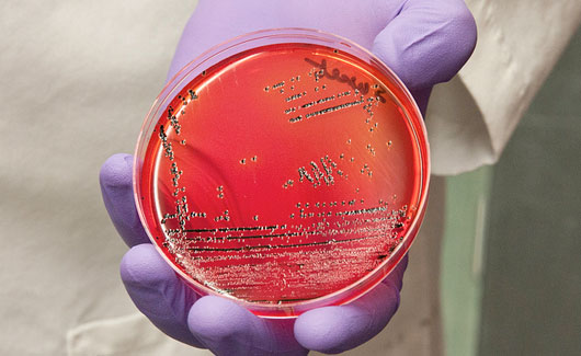 A scientist with a purple rubber glove and a white coat holds a petri dish filled with a red substance.